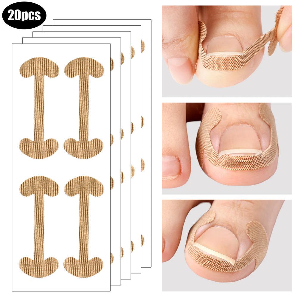 Toenail Correction Strips