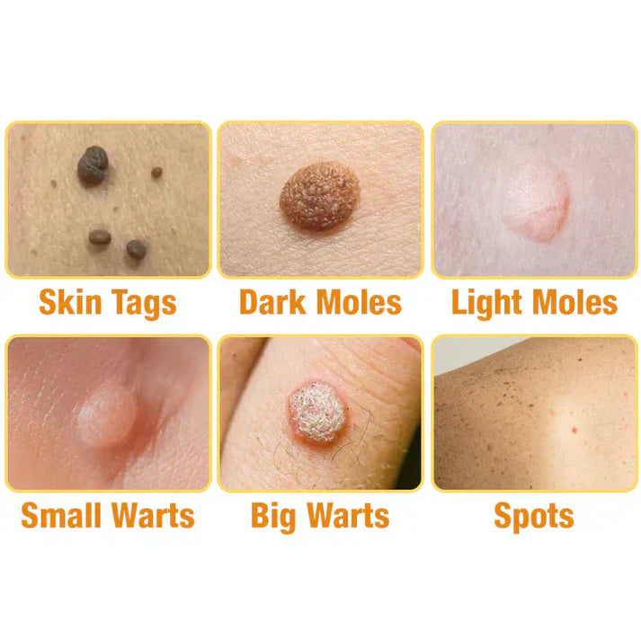 Treatment SprayAQA™ TagRecede Bee Venom