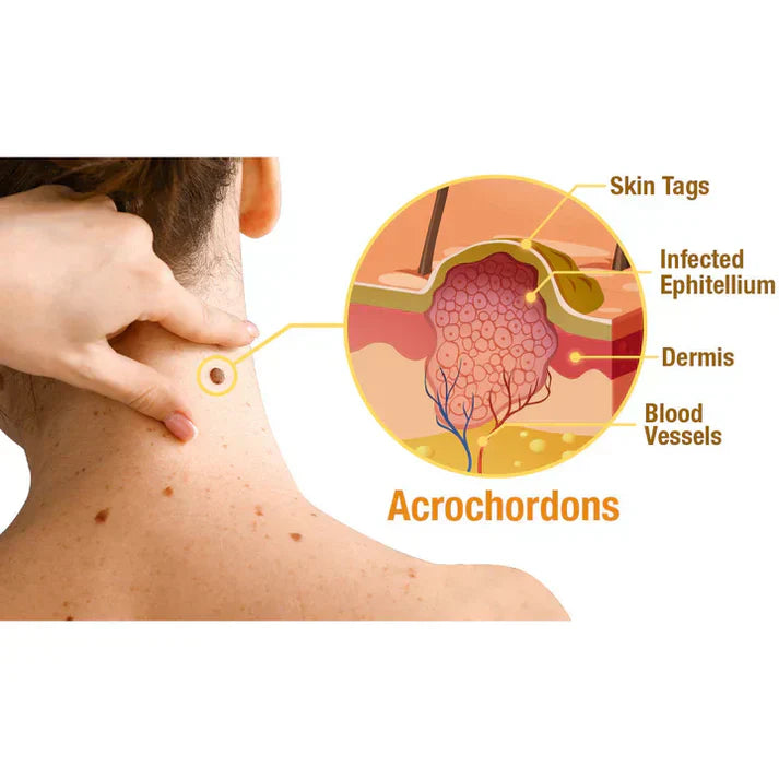Treatment SprayAQA™ TagRecede Bee Venom