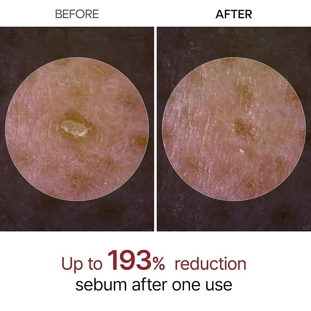 white Rice Peeling Ampoule