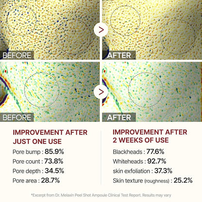 white Rice Peeling Ampoule